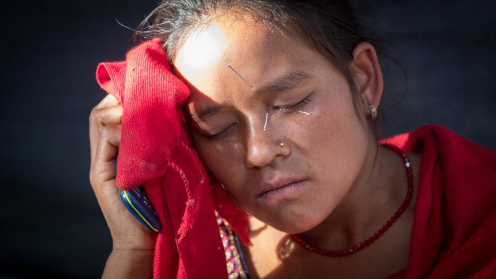 Acupuncture Relief Project